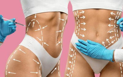 Medicina Estética especialidad problemática